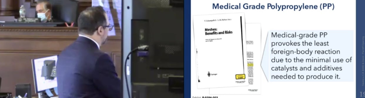 Opening Statements Take Place In Bellwether Hernia Mesh Trial Watch 